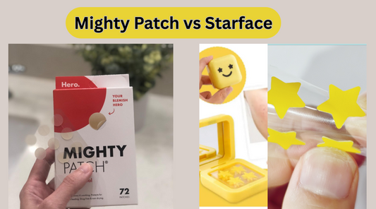 Mighty Patch vs Starface