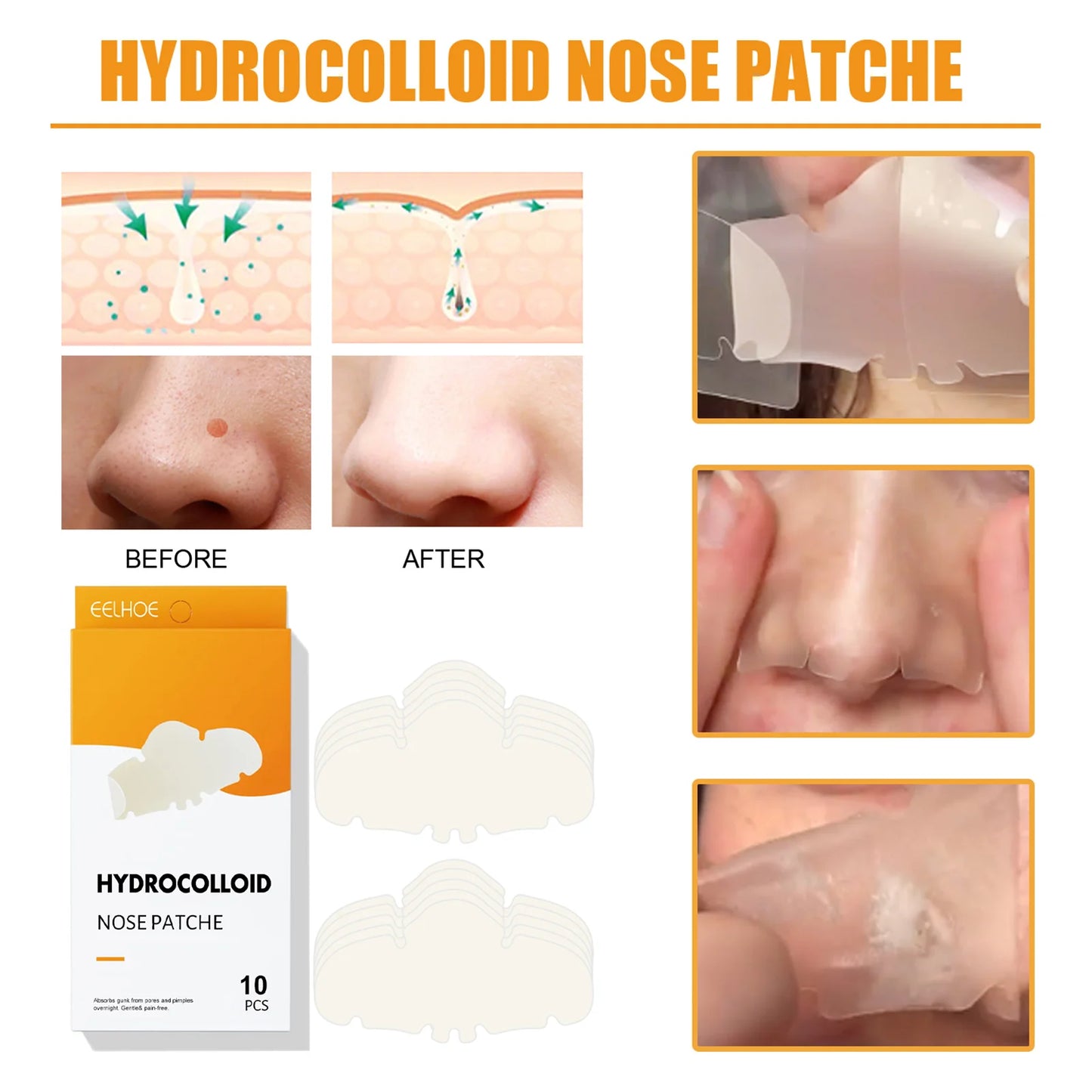 Hydrocolloid Nose Patches for Blackheads – Radiant Glow Hub