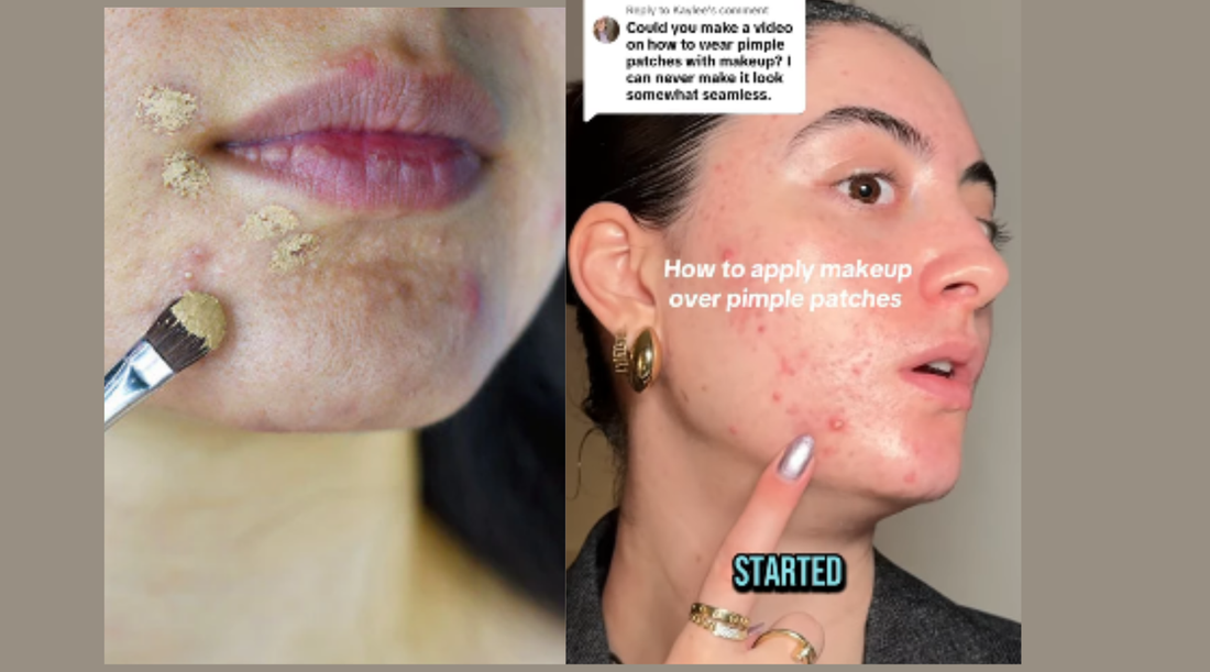 Can You Put Makeup Over a Pimple Patch