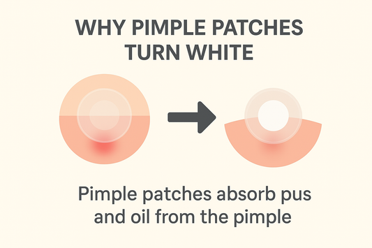 why do pimple patches turn white