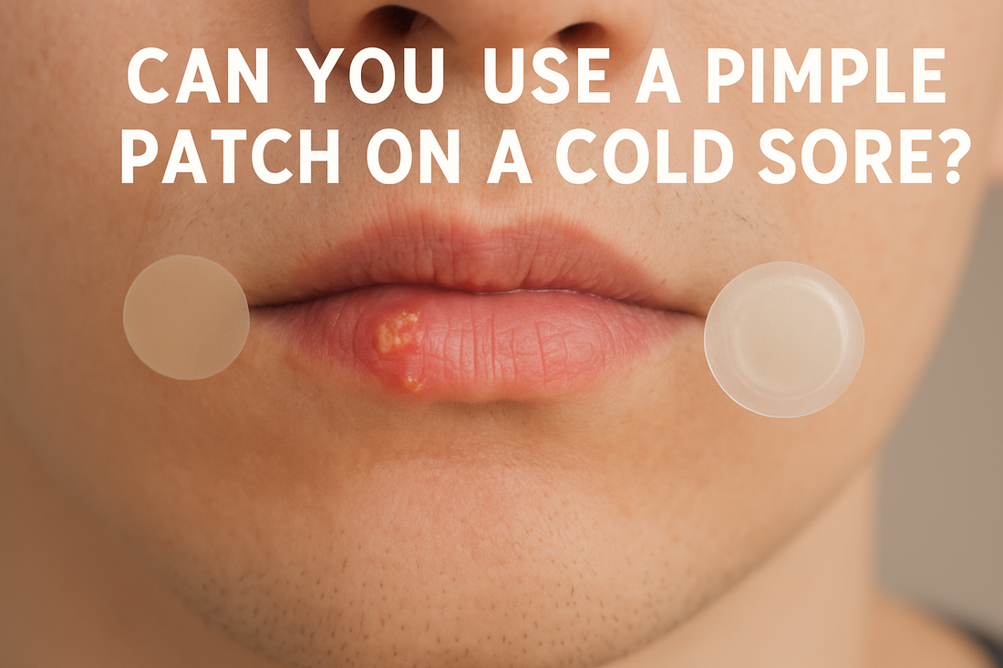 can i put a pimple patch on a cold sore