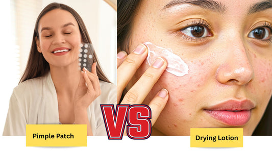 pimple patch vs drying lotion