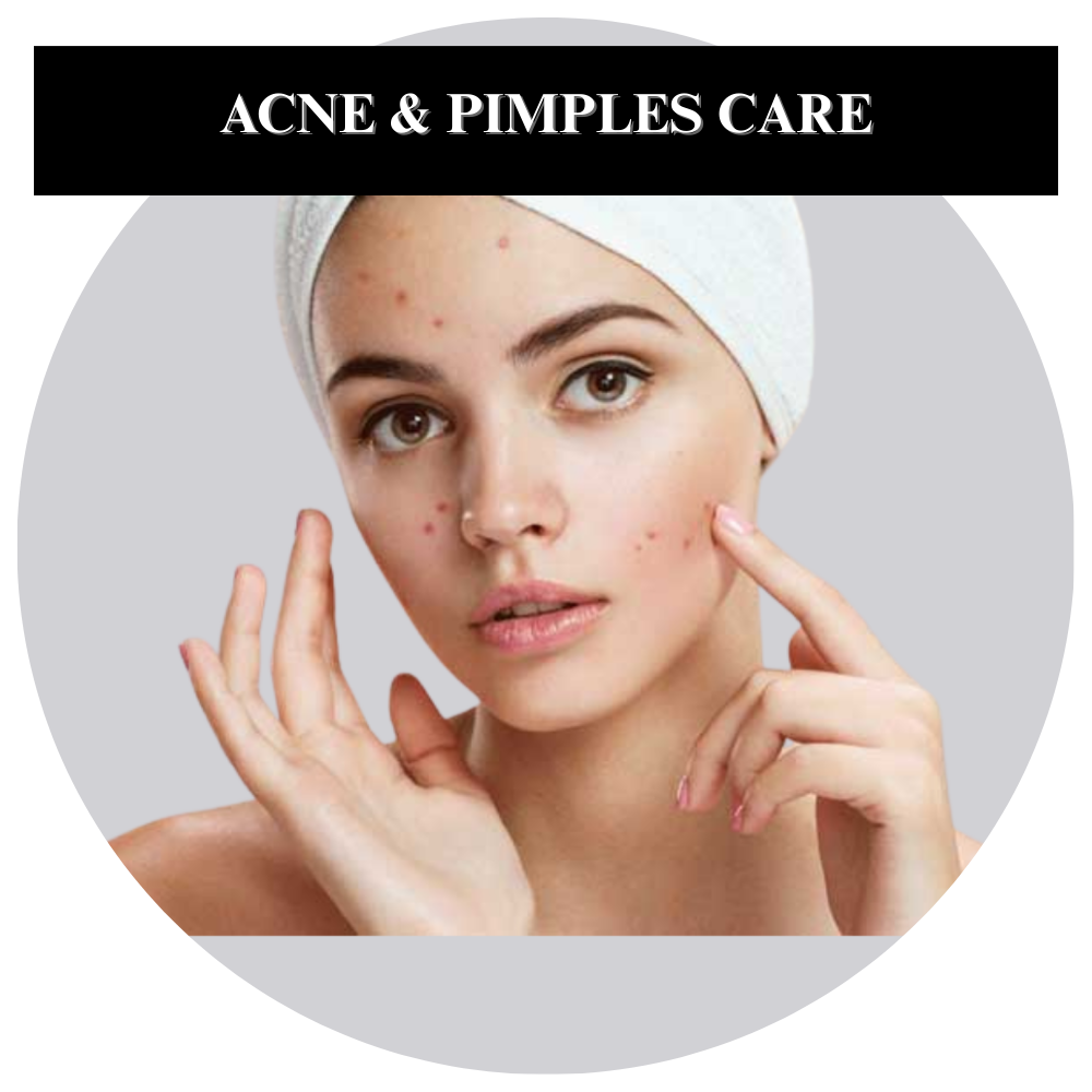 Acne Care